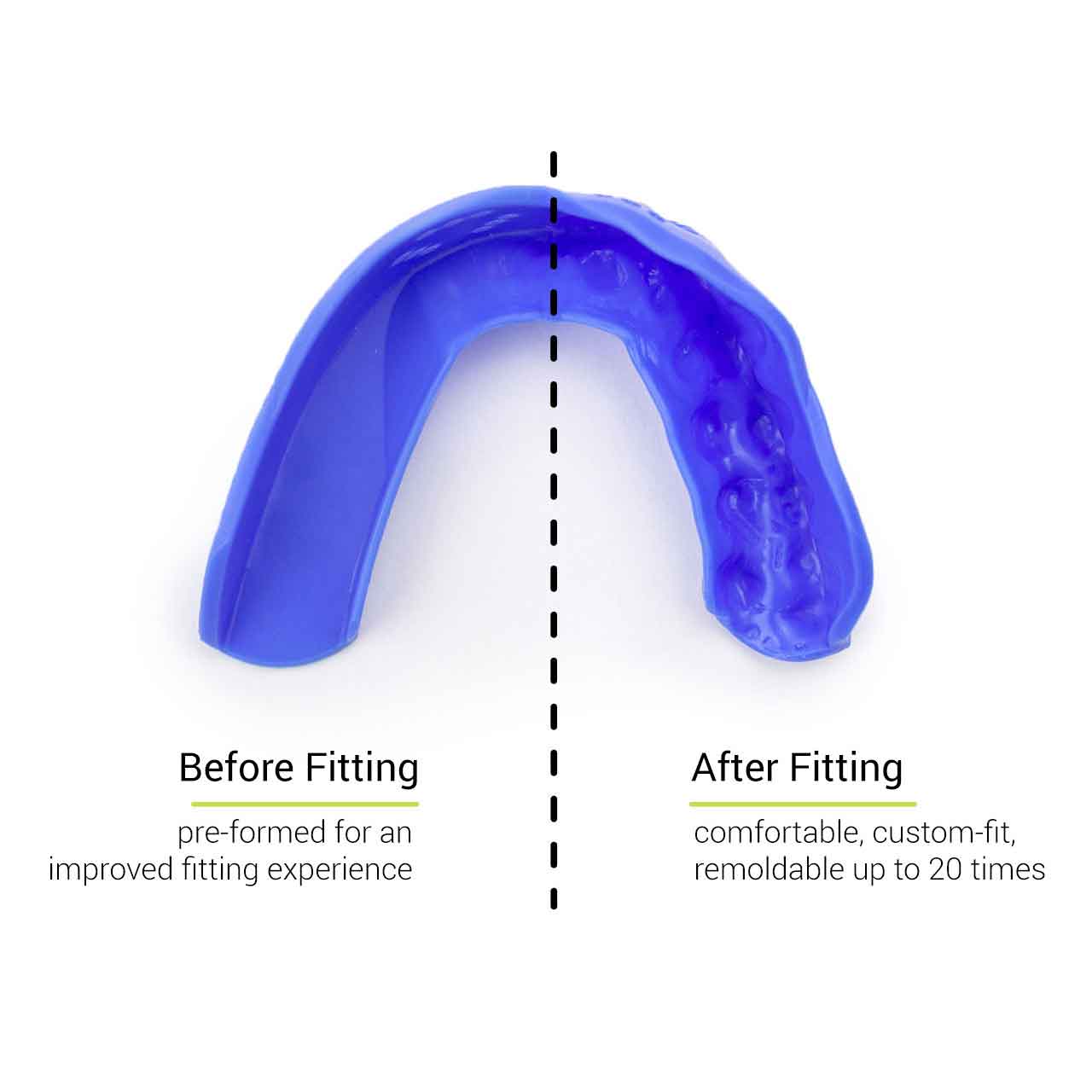 SISU 3D Custom Fit Mouthguard showing before and after fitting images.